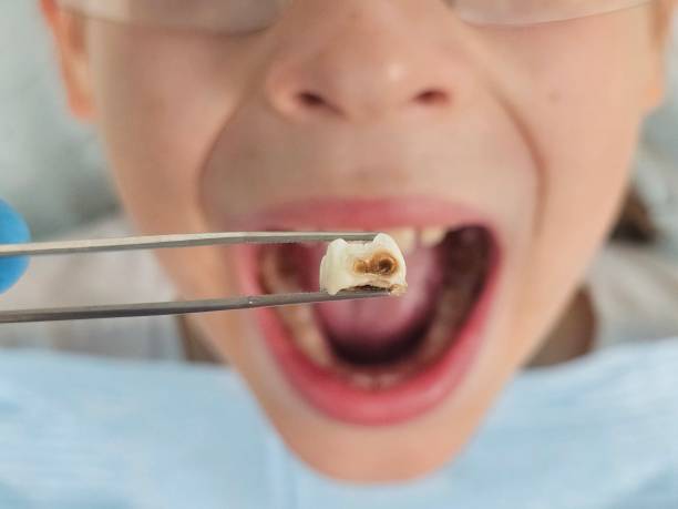 Best Emergency Treatment for Toothache in Wellsville, KS